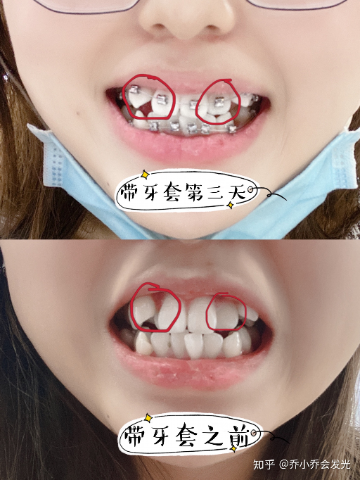 宠物兔牙齿过长如何处理？兔子牙齿修剪技术怎么样？口碑评价如何？